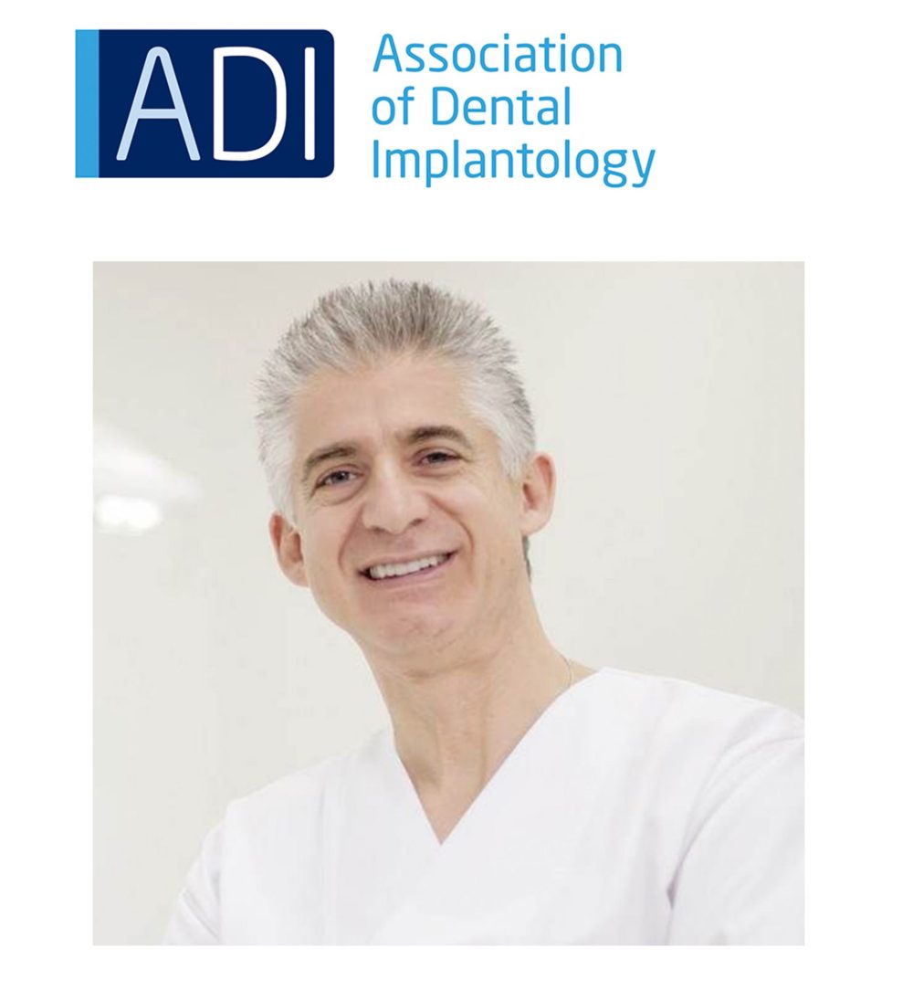 Optimising success of immediate loading with permanent restorations – Dr Costa Nicolopoulos.
