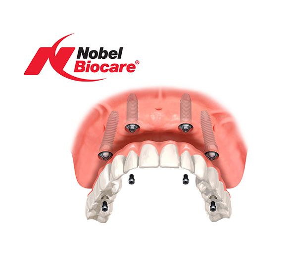 Take All-On-4® to the next level of innovation