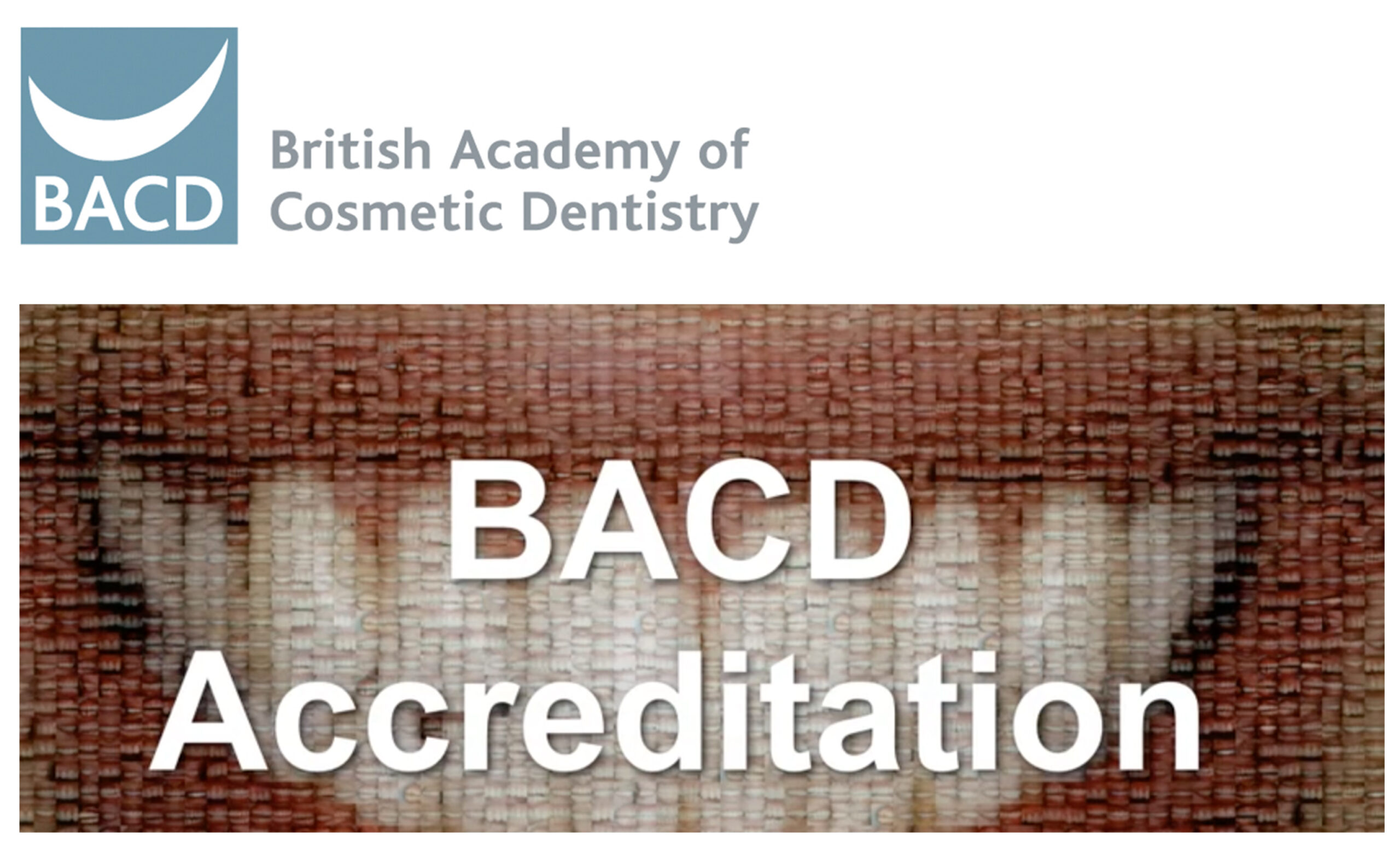 Unlock the next level with the BACD