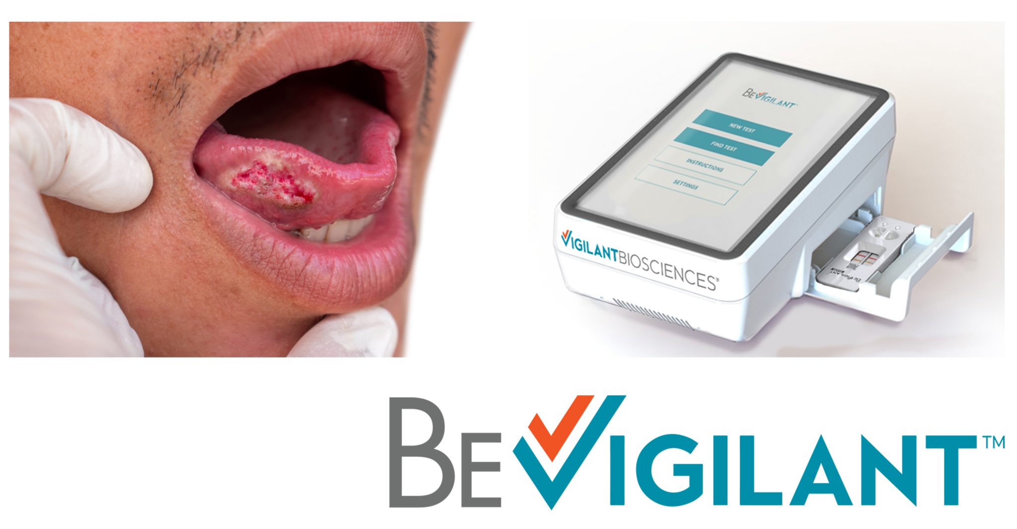 Oral cancer screening in every appointment