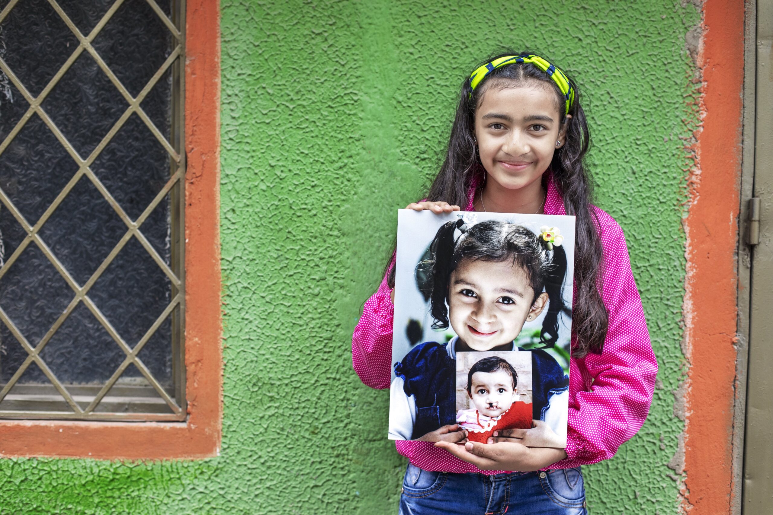 EAS provides a legacy with bite for children with cleft conditions