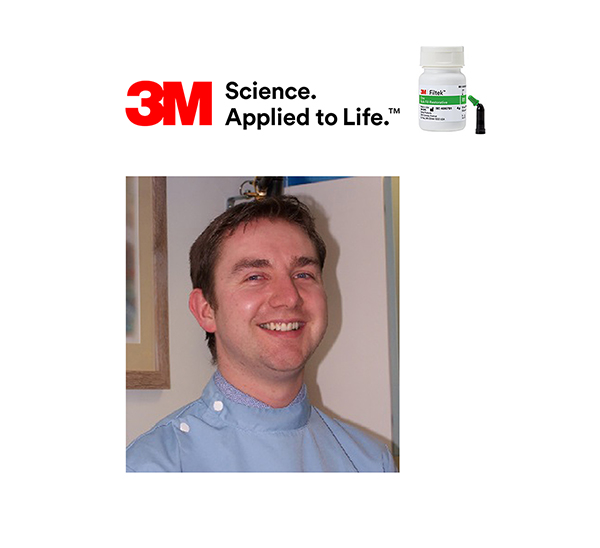 Reliability and Research – Filtek One