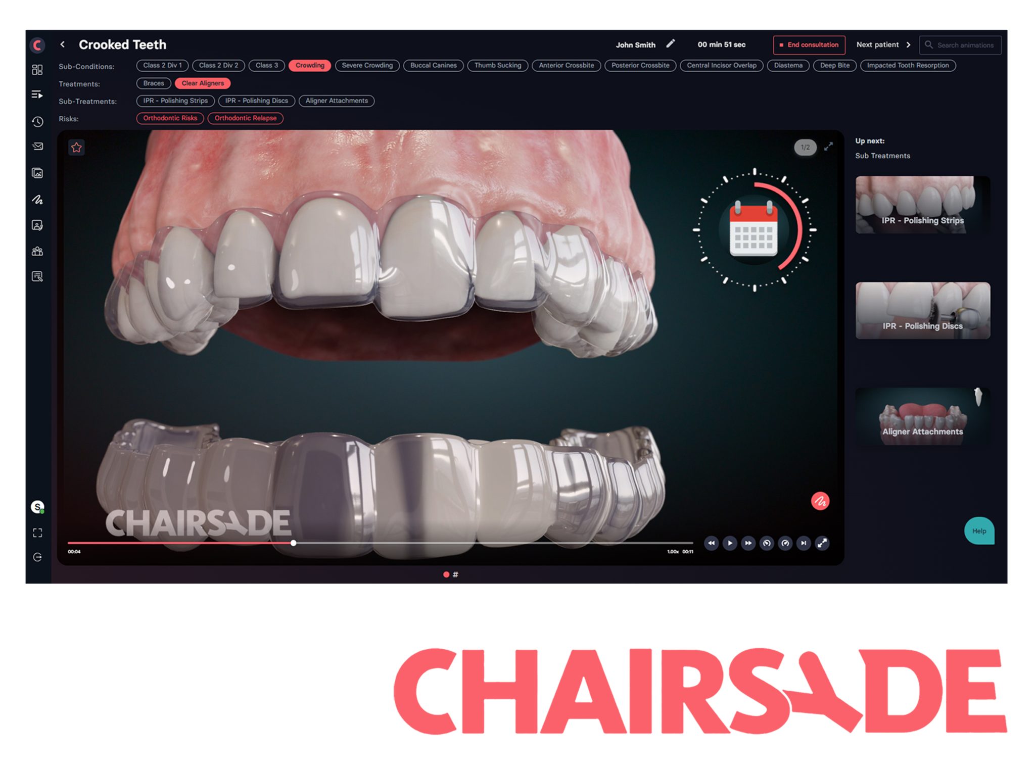 Optimise patient communication with Chairsyde – Stand K34