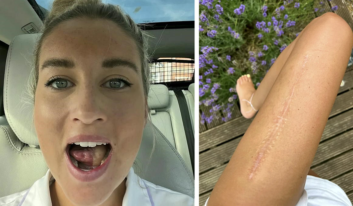 Mouth cancer in young people: Charlotte’s story