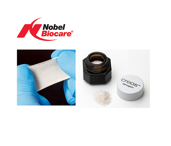 The membrane of choice