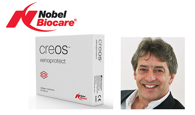 Embracing innovation – Nobel Biocare