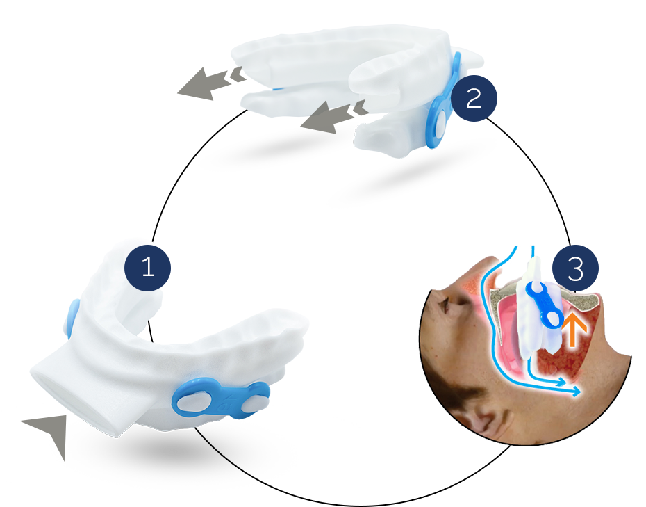 What are the health benefits of sleep?