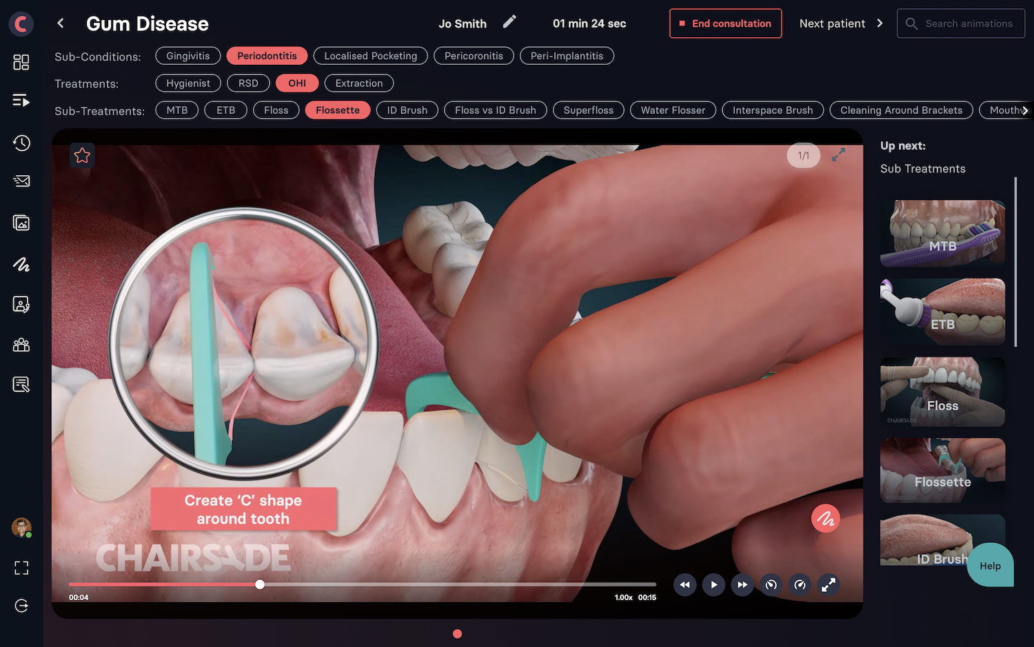 Communication and understanding of gingival disease