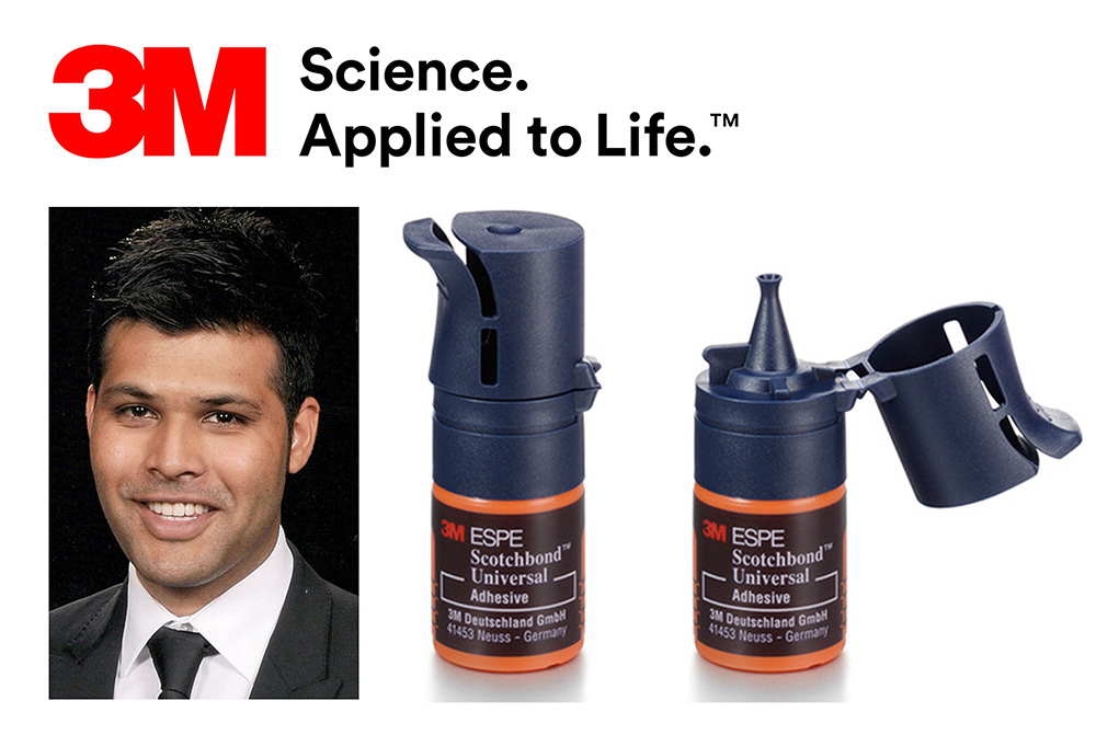 ‘A phenomenal product’  “Scotchbond Universal is a phenomenal product.”