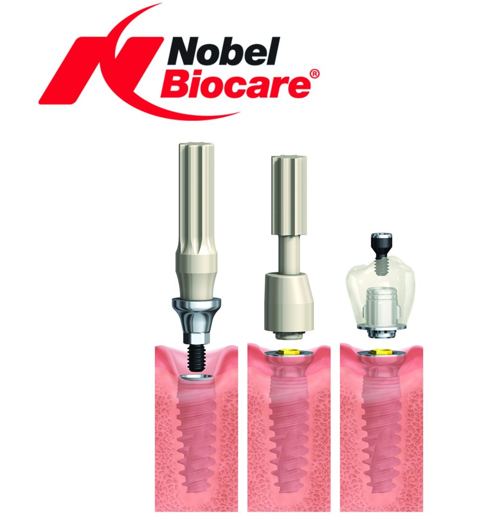 Flexibility with one base, one time