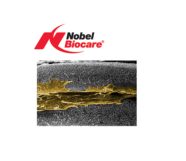 TiUnite Proven Successful Once Again