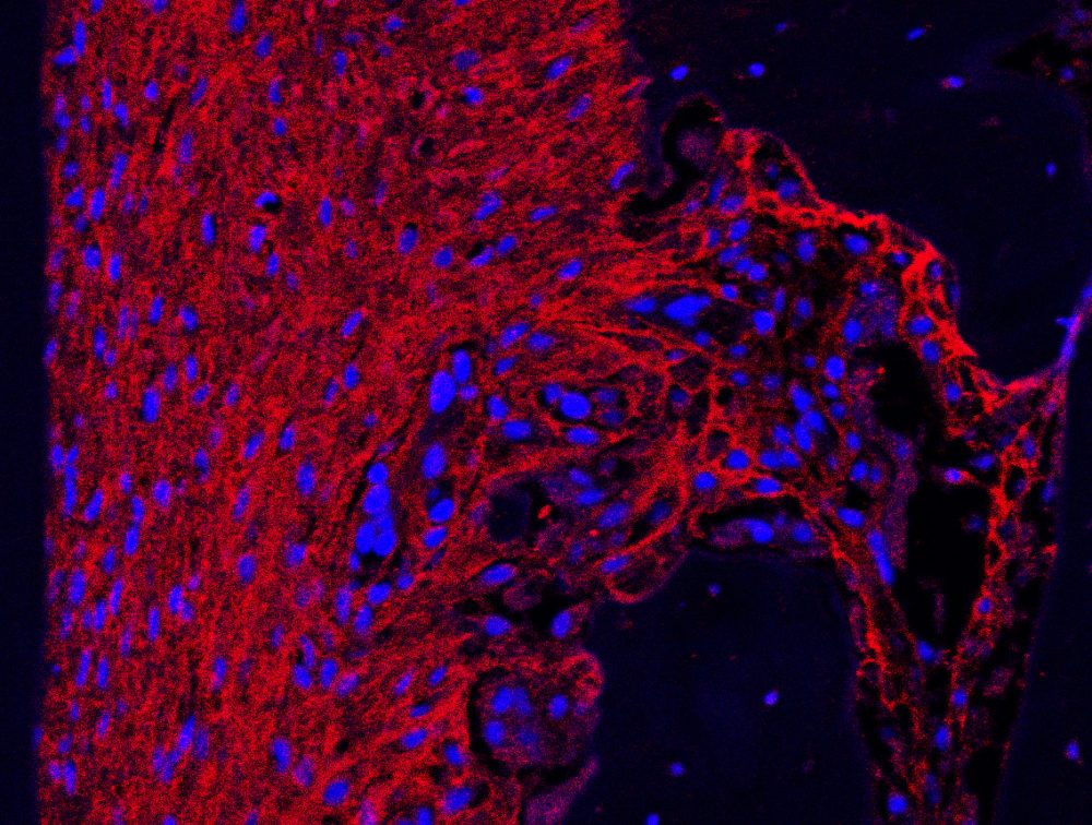 Scientists uncover new molecules that could help regeneration and tackle tooth loss