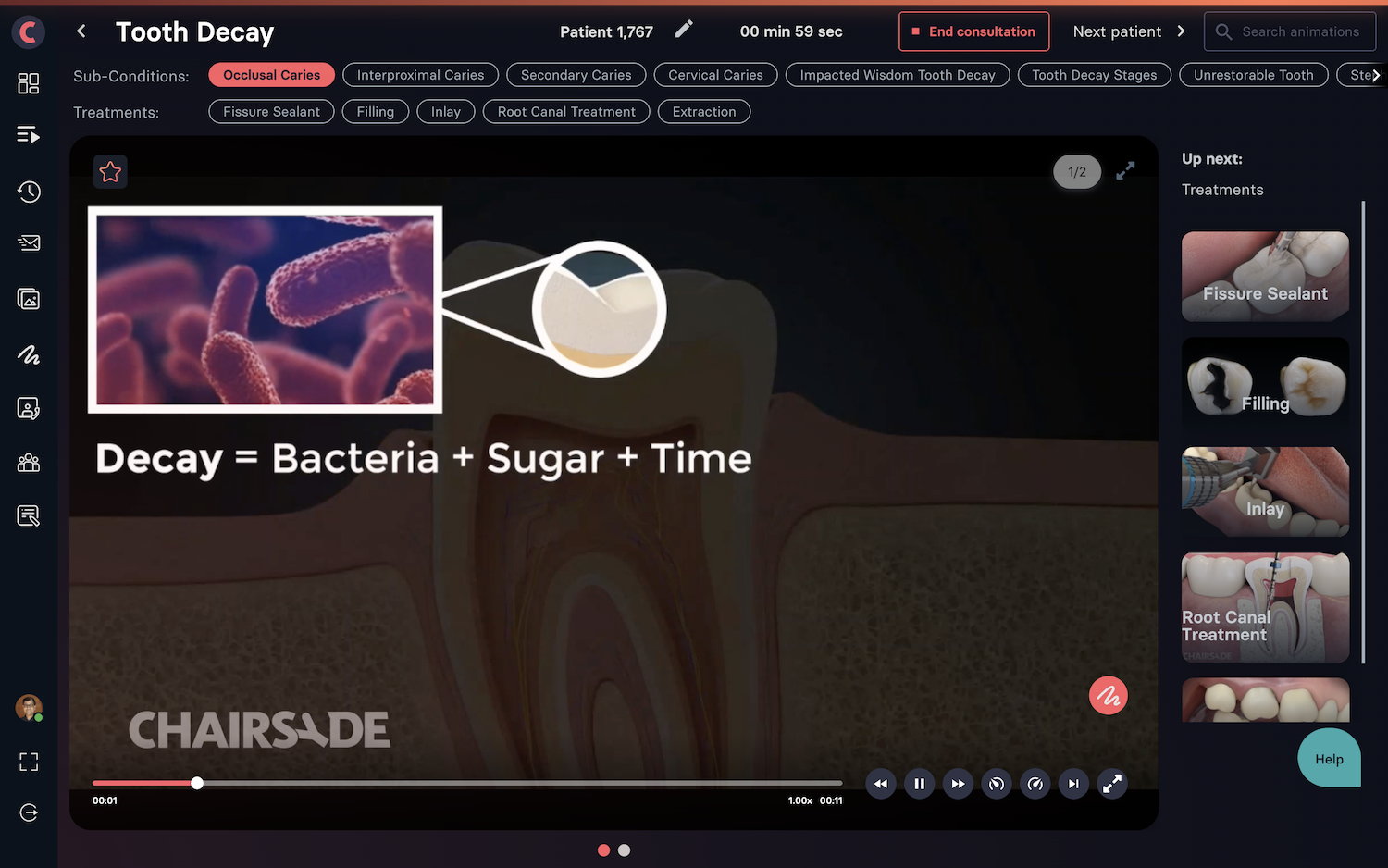 Accelerating the decline in dental decay