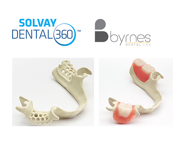 Fantastic retention, comfort and fit