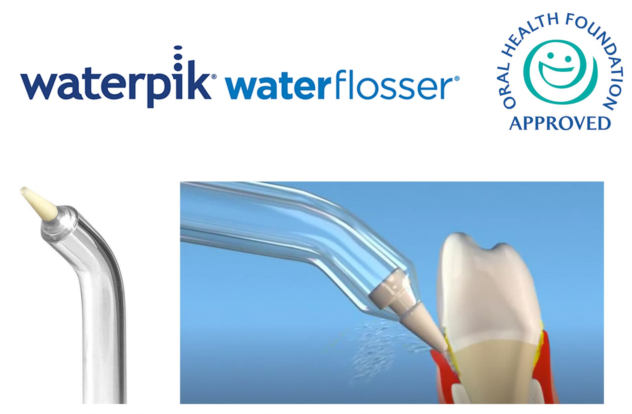 Improving periodontal maintenance