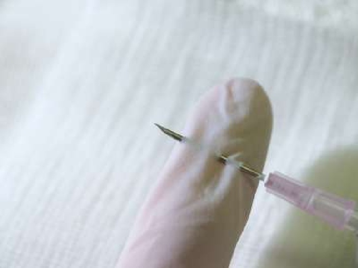 Small injuries, big consequences