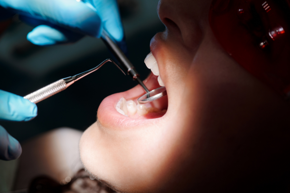 Mouth cancer referrals plummet by a third since start of pandemic