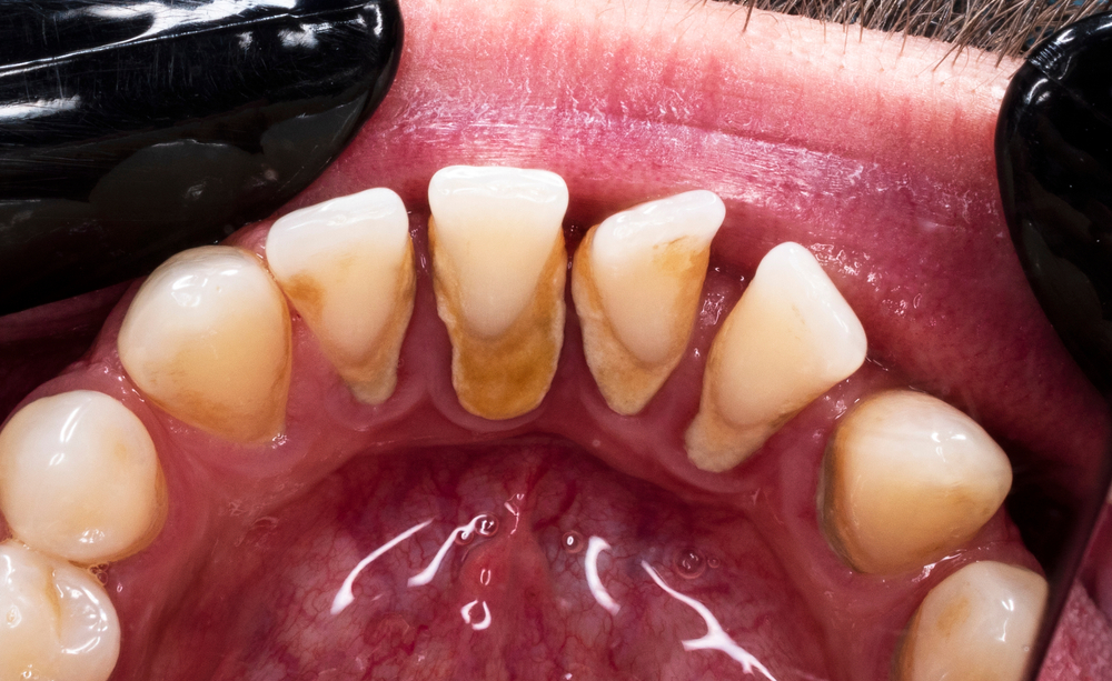 Embarrassed by their oral health? How to help people feel less awkward at the dentist, whatever the reason why