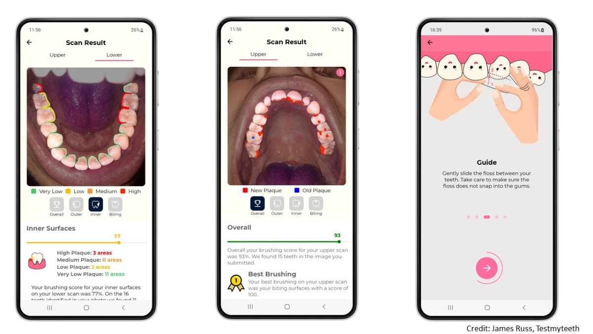 University of Bath graduate launches innovative smartphone app to test dental plaque