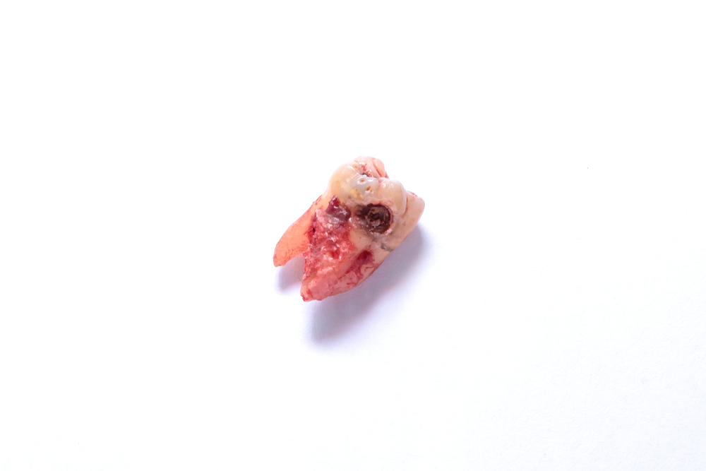 Differentiating anatomical waste