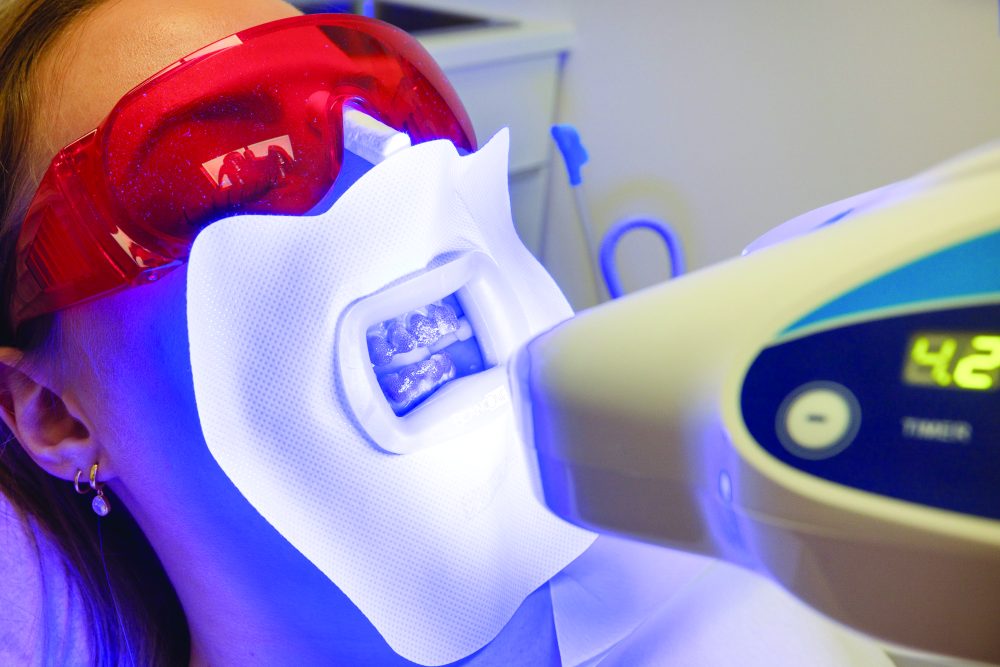 In-office teeth whitening methods under review