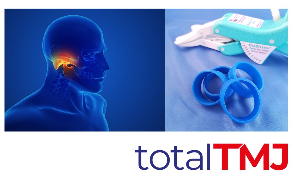 The TMD solution