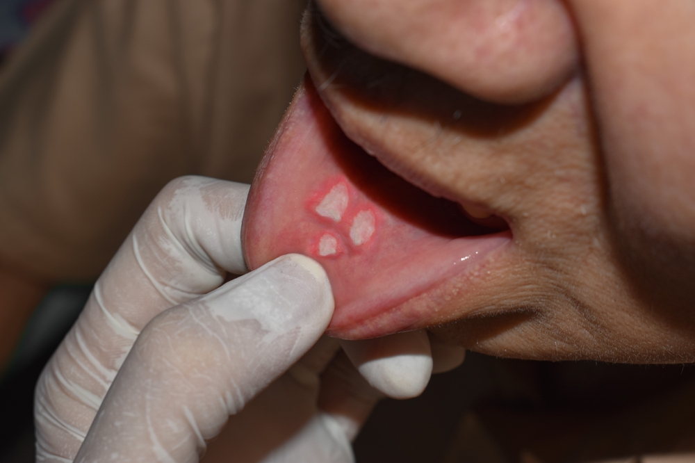 When it hurts more, they floss less: unpicking a counterintuitive truth