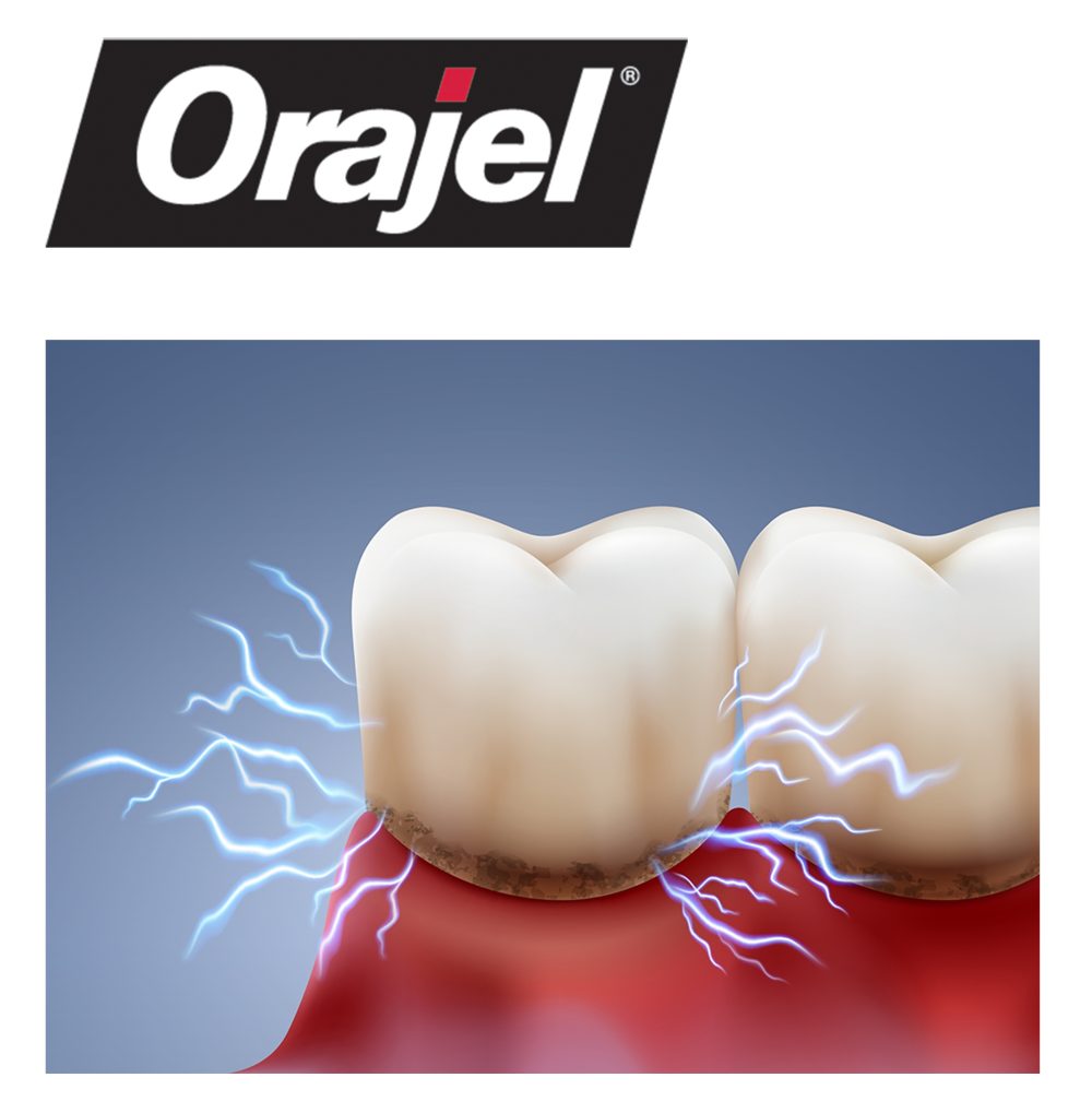 Orajel®: a safe pain relief recommendation for older patients